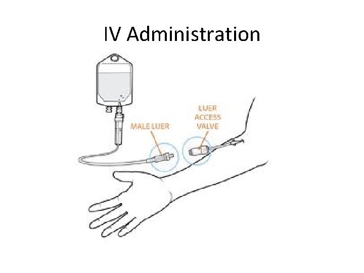 IV Administration 