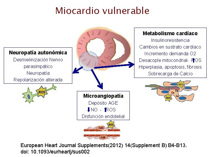 Miocardio vulnerable Metabolismo cardíaco Insulinoresistencia Cambios en sustrato cardíaco Incremento demanda O 2 Desacople