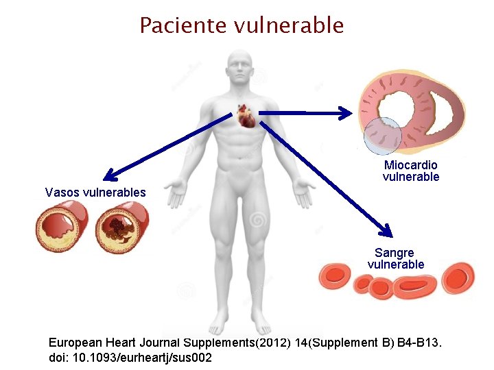 Paciente vulnerable Miocardio vulnerable Vasos vulnerables Sangre vulnerable European Heart Journal Supplements(2012) 14(Supplement B)
