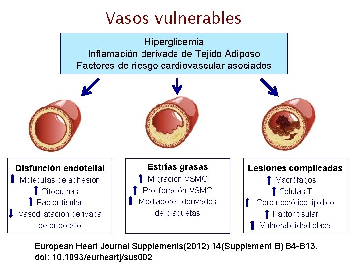Vasos vulnerables Hiperglicemia Inflamación derivada de Tejido Adiposo Factores de riesgo cardiovascular asociados Disfunción