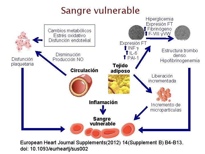Sangre vulnerable Cambios metabólicos Estrés oxidativo Disfunción endotelial Disfunción plaquetaria Expresión FT INF g