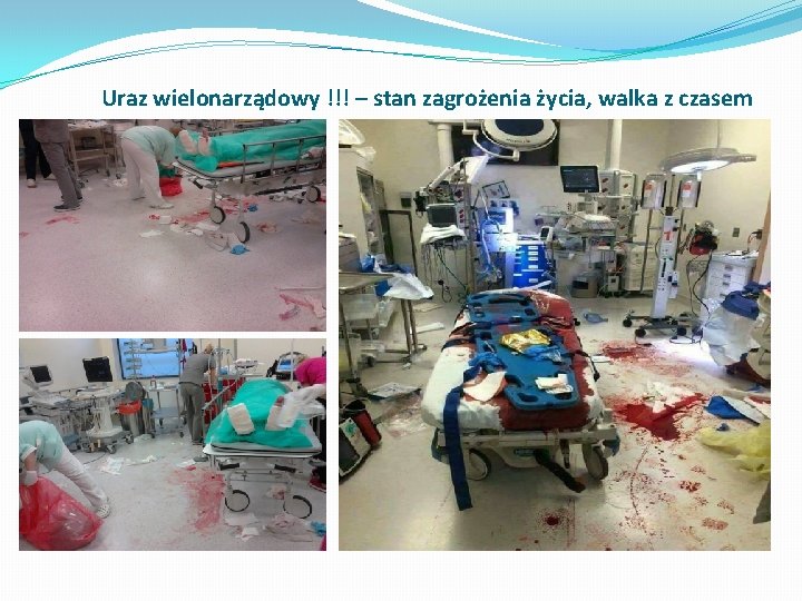 Uraz wielonarządowy !!! – stan zagrożenia życia, walka z czasem 
