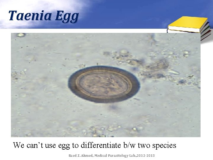 Taenia Egg We can’t use egg to differentiate b/w two species Raed Z. Ahmed,