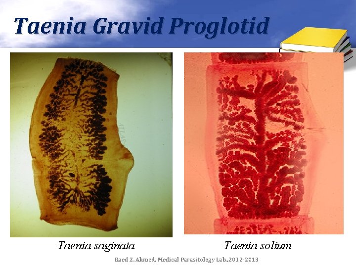 Taenia Gravid Proglotid Taenia saginata Taenia solium Raed Z. Ahmed, Medical Parasitology Lab. ,