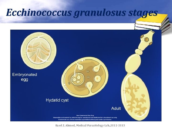Ecchinococcus granulosus stages Raed Z. Ahmed, Medical Parasitology Lab. , 2012 -2013 