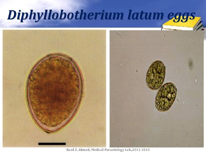 Diphyllobotherium latum eggs Raed Z. Ahmed, Medical Parasitology Lab. , 2012 -2013 