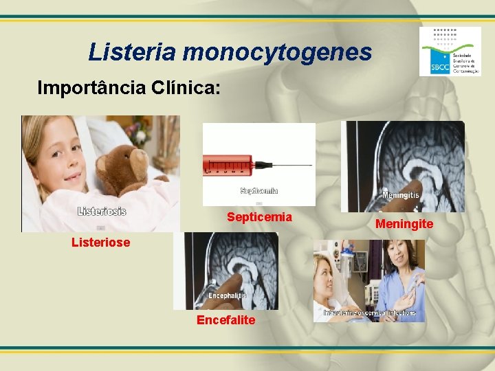 Listeria monocytogenes Importância Clínica: Septicemia Listeriose Encefalite Meningite 