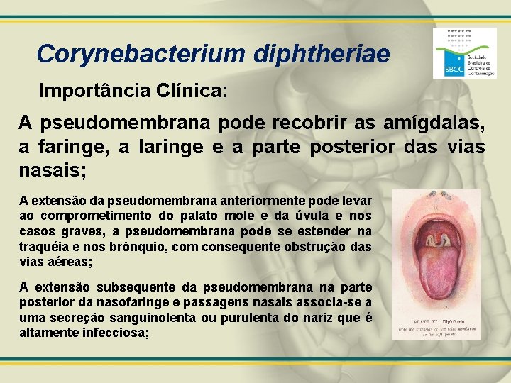 Corynebacterium diphtheriae Importância Clínica: A pseudomembrana pode recobrir as amígdalas, a faringe, a laringe