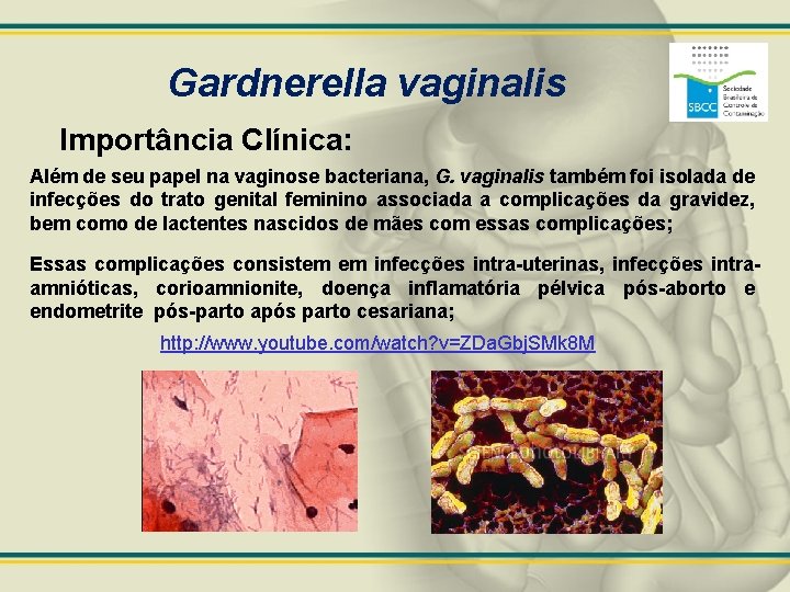 Gardnerella vaginalis Importância Clínica: Além de seu papel na vaginose bacteriana, G. vaginalis também