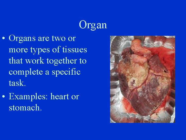 Organ • Organs are two or more types of tissues that work together to