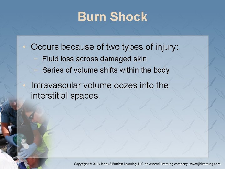 Burn Shock • Occurs because of two types of injury: − Fluid loss across