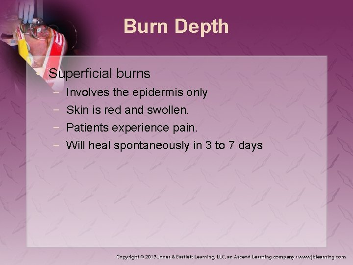 Burn Depth • Superficial burns − − Involves the epidermis only Skin is red