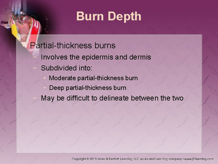 Burn Depth • Partial-thickness burns − Involves the epidermis and dermis − Subdivided into: