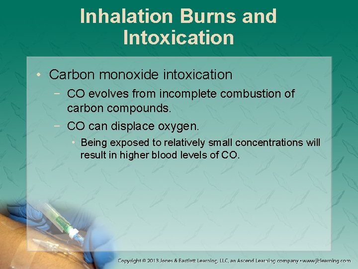 Inhalation Burns and Intoxication • Carbon monoxide intoxication − CO evolves from incomplete combustion
