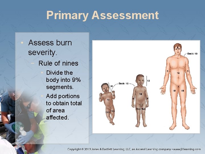 Primary Assessment • Assess burn severity. − Rule of nines • Divide the body