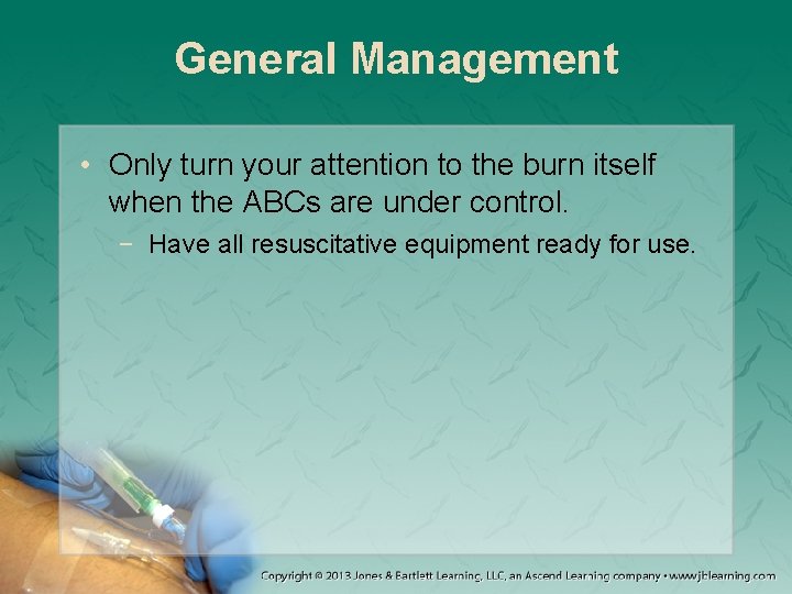 General Management • Only turn your attention to the burn itself when the ABCs