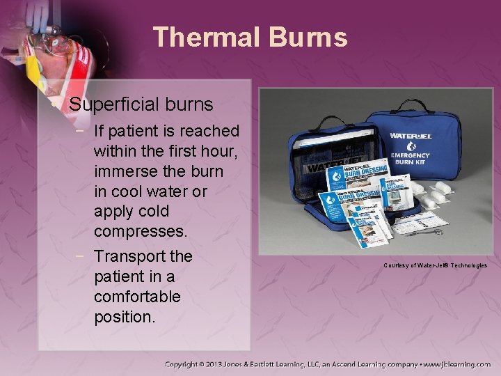 Thermal Burns • Superficial burns − If patient is reached within the first hour,