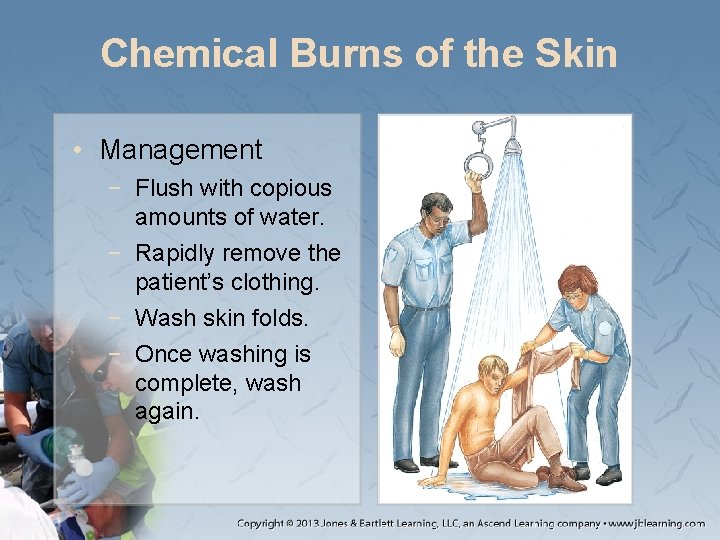 Chemical Burns of the Skin • Management − Flush with copious amounts of water.
