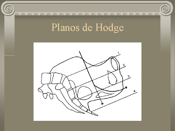 Planos de Hodge 