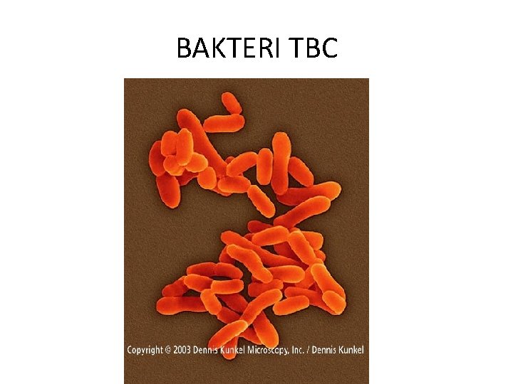 BAKTERI TBC 