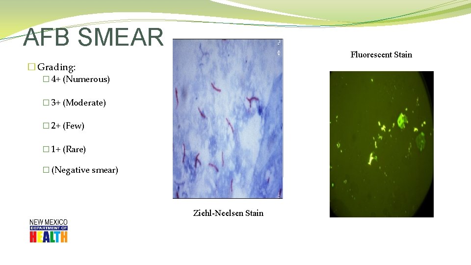 AFB SMEAR Fluorescent Stain � Grading: � 4+ (Numerous) � 3+ (Moderate) � 2+