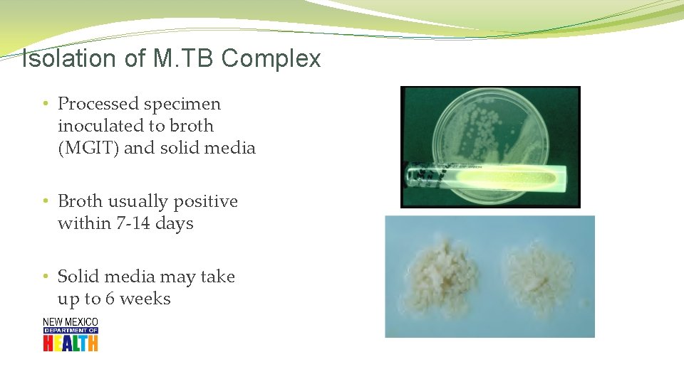 Isolation of M. TB Complex • Processed specimen inoculated to broth (MGIT) and solid