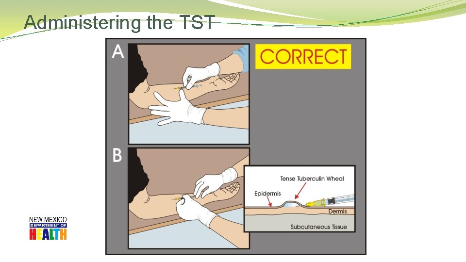 Administering the TST 