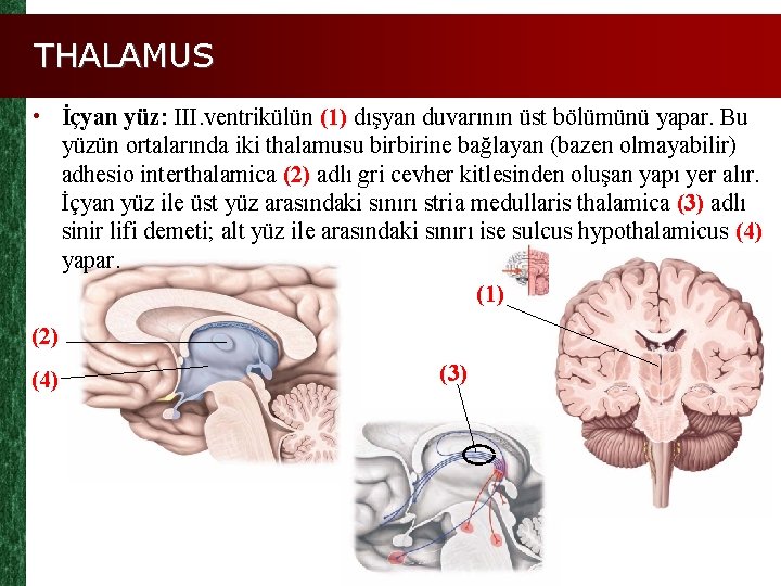 THALAMUS • İçyan yüz: III. ventrikülün (1) dışyan duvarının üst bölümünü yapar. Bu yüzün