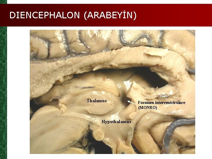 DIENCEPHALON (ARABEYİN) Thalamus Hypothalamus Foramen interventriculare (MONRO) 