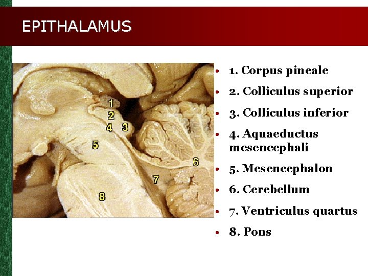 EPITHALAMUS • 1. Corpus pineale • 2. Colliculus superior • 3. Colliculus inferior •