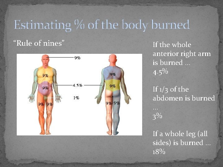 Estimating % of the body burned “Rule of nines” If the whole anterior right