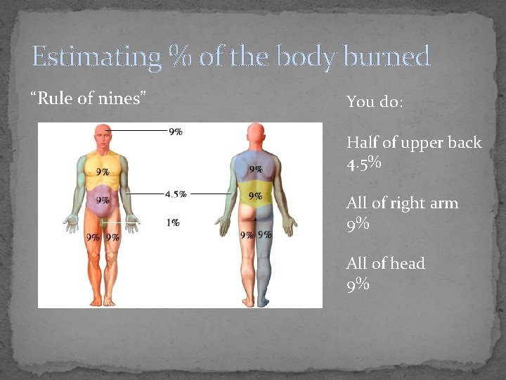 Estimating % of the body burned “Rule of nines” You do: Half of upper