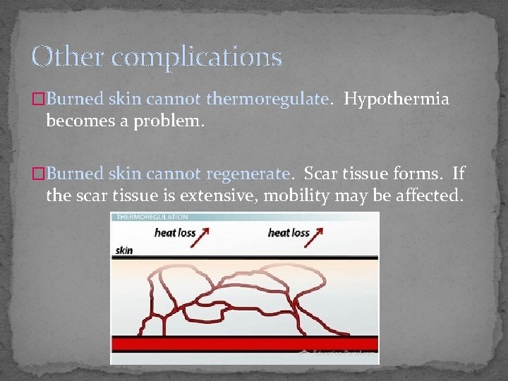 Other complications �Burned skin cannot thermoregulate. Hypothermia becomes a problem. �Burned skin cannot regenerate.