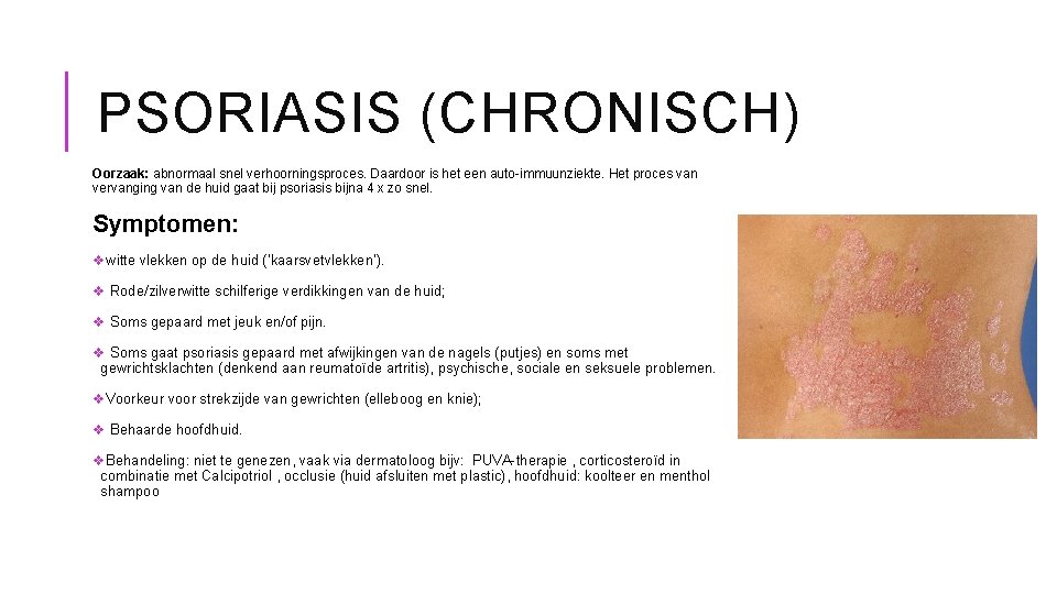 PSORIASIS (CHRONISCH) Oorzaak: abnormaal snel verhoorningsproces. Daardoor is het een auto-immuunziekte. Het proces van