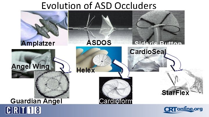 Evolution of ASD Occluders Amplatzer Angel Wing ASDOS Sideris Button Cardio. Seal Helex Star.