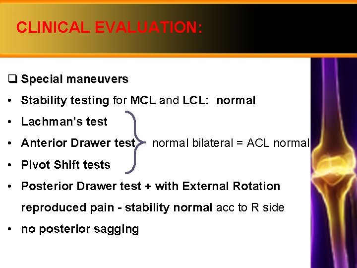 CLINICAL EVALUATION: q Special maneuvers • Stability testing for MCL and LCL: normal •