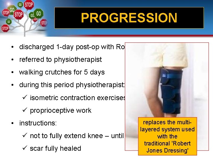 PROGRESSION • discharged 1 -day post-op with Robert Jones bandage • referred to physiotherapist