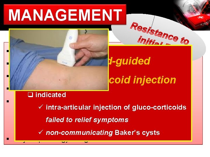 MANAGEMENT § review diagnosis Ultrasound-guided § ? persistent underlying knee pathology § repeat of