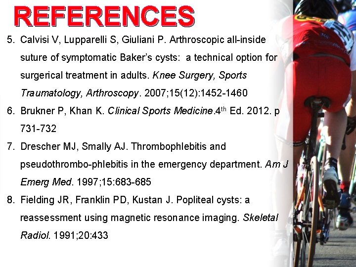 REFERENCES 5. Calvisi V, Lupparelli S, Giuliani P. Arthroscopic all-inside suture of symptomatic Baker’s