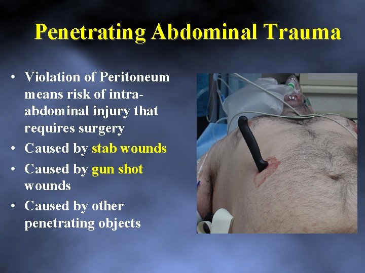 Penetrating Abdominal Trauma • Violation of Peritoneum means risk of intra abdominal injury that