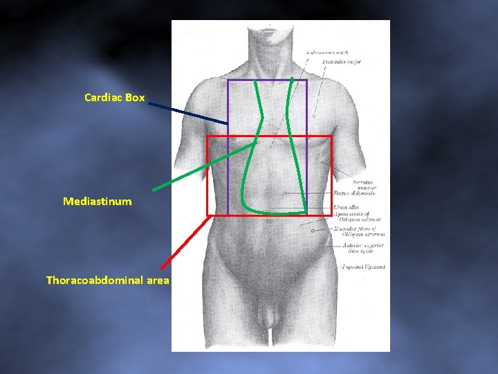 Cardiac Box Mediastinum Thoracoabdominal area 