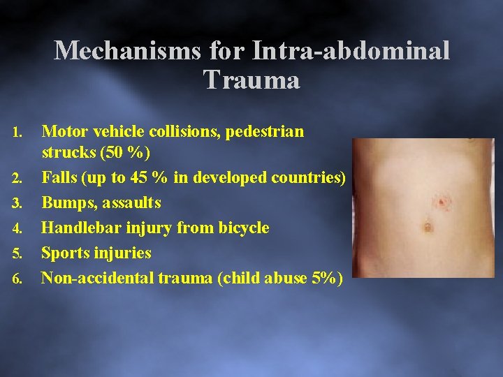 Mechanisms for Intra abdominal Trauma 1. 2. 3. 4. 5. 6. Motor vehicle collisions,