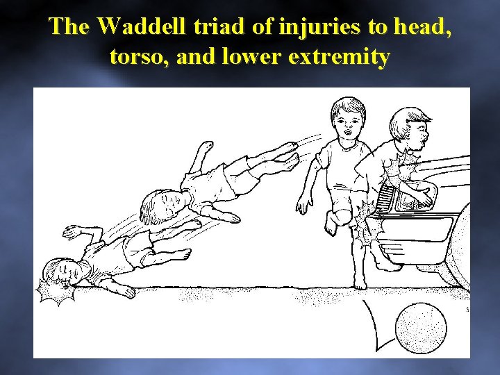 The Waddell triad of injuries to head, torso, and lower extremity 