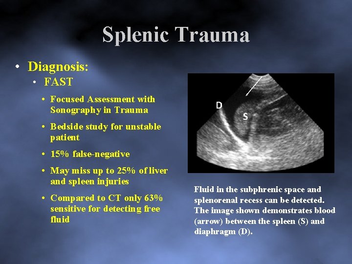 Splenic Trauma • Diagnosis: • FAST • Focused Assessment with Sonography in Trauma •