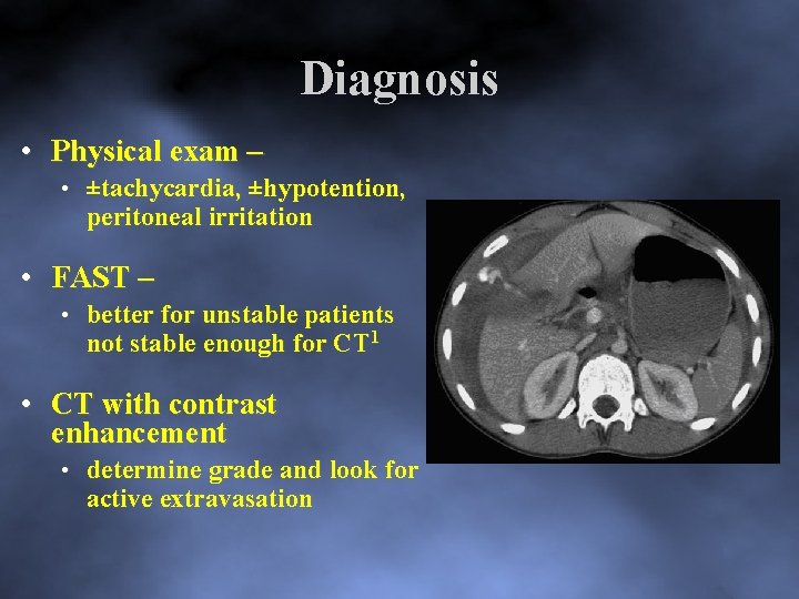 Diagnosis • Physical exam – • ±tachycardia, ±hypotention, peritoneal irritation • FAST – •
