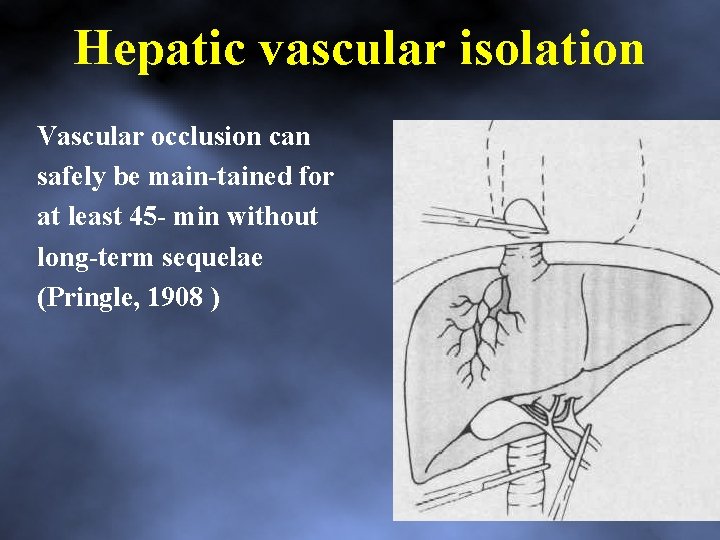 Hepatic vascular isolation Vascular occlusion can safely be main tained for at least 45
