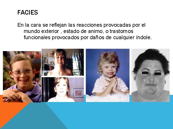 FACIES En la cara se reflejan las reacciones provocadas por el mundo exterior ,