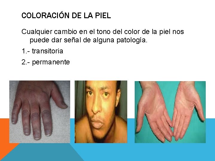 COLORACIÓN DE LA PIEL Cualquier cambio en el tono del color de la piel