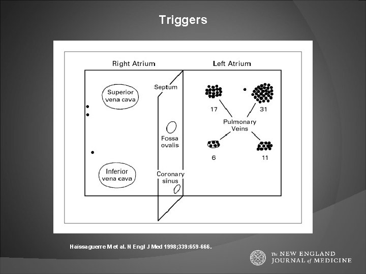 Triggers Haïssaguerre M et al. N Engl J Med 1998; 339: 659 -666. 