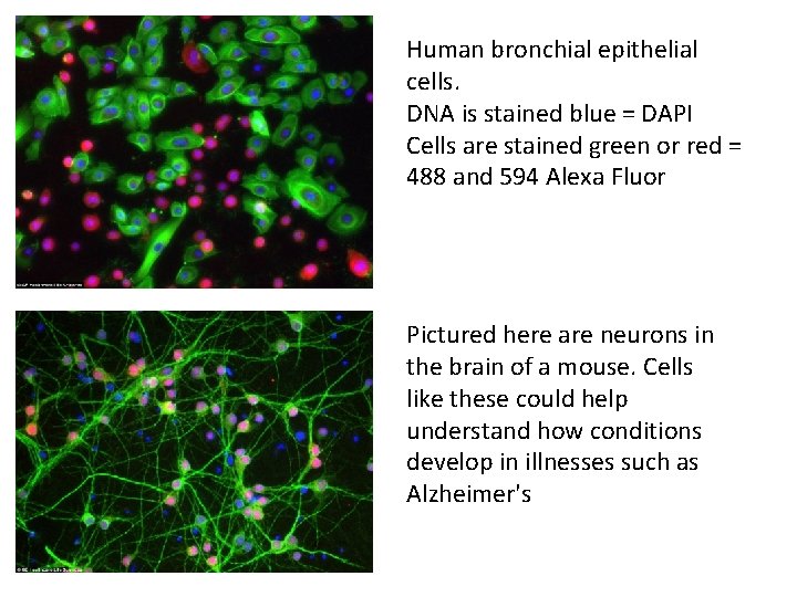 Human bronchial epithelial cells. DNA is stained blue = DAPI Cells are stained green